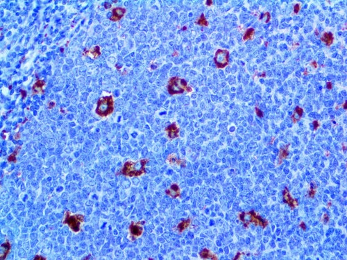 IHC of CD68 KP1 on an FFPE Tonsil Tissue
